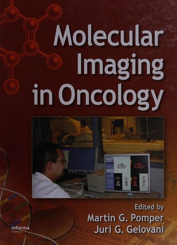 Molecular Imaging in Oncology