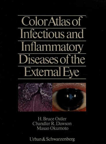 Color atlas of infectious and inflammatory diseases of the external eye