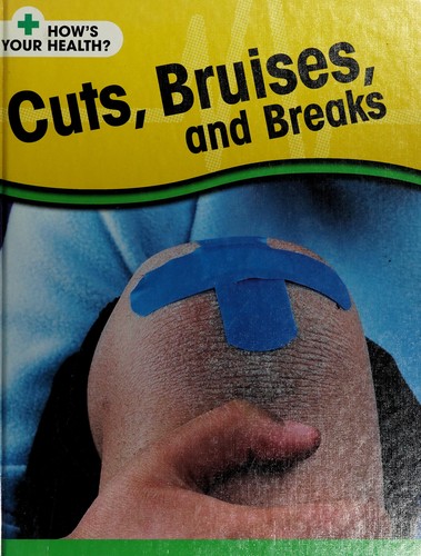 Cuts, bruises, and breaks