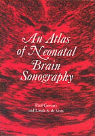 An Atlas of neonatal brain sonography