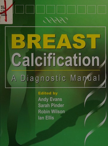 Breast calcification