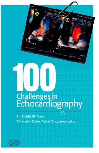 100 challenges in echocardiography