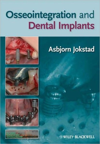 Osseointegration and dental implants