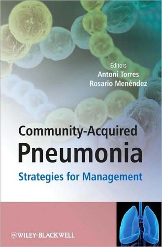 Community-acquired pneumonia